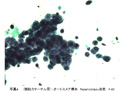 症例8