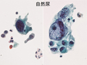 症例5