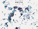 症例5