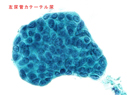 症例8