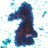 症例3